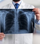 בדיקות גנומיות: כיצד הן יכולות להאריך את חייהם של חולי סרטן הריאה?       -תמונה